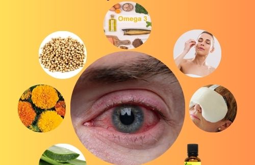 10 Natural Treatment for Blepharitis