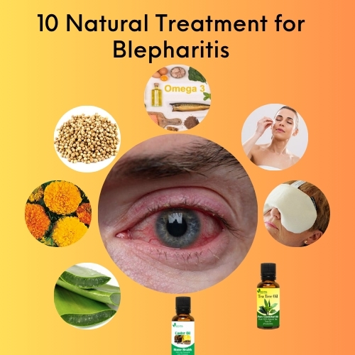 10 Natural Treatment for Blepharitis