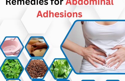 11 Natural Home Remedies for Abdominal Adhesions