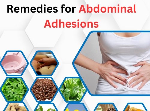 11 Natural Home Remedies for Abdominal Adhesions