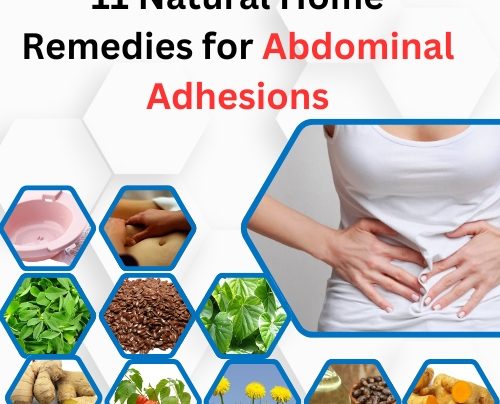 11 Natural Home Remedies for Abdominal Adhesions