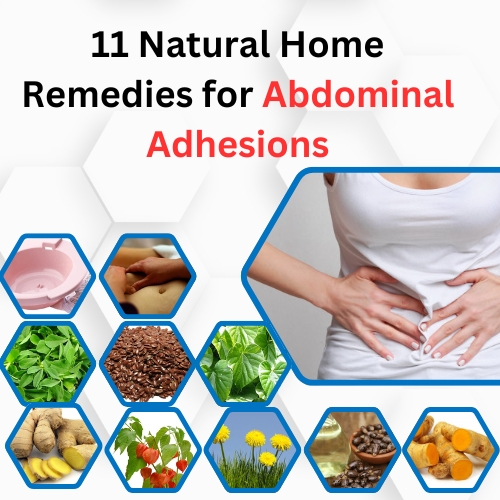 11 Natural Home Remedies for Abdominal Adhesions