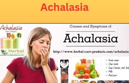 8 Herbal Treatments for Achalasia