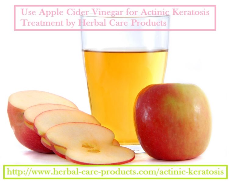 Actinic Keratosis Natural Treatment - Herbal Care Products - Blog