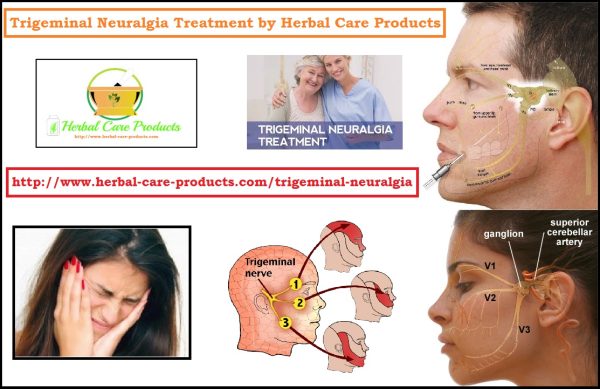 10 Natural Remedies for Trigeminal Neuralgia