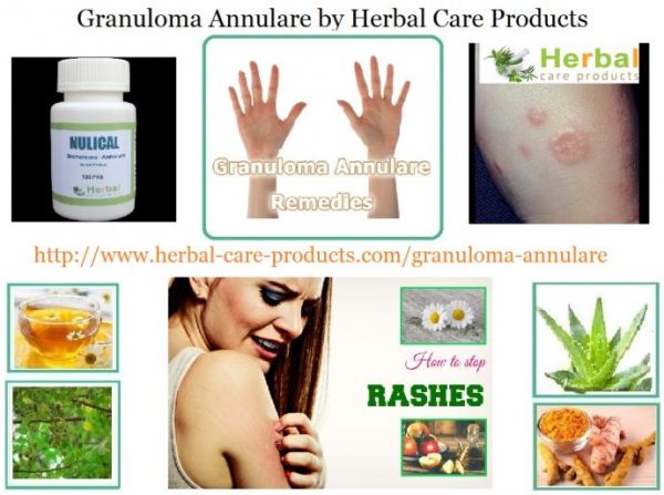 www.herbal-care-products.com