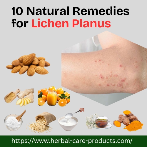 10 Natural Remedies for Lichen Planus