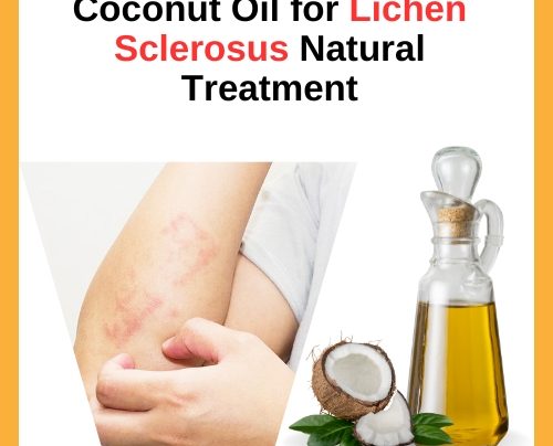 Coconut Oil for Lichen Sclerosus Natural Treatment