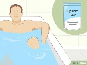 Epsom Salt for Hydrocele