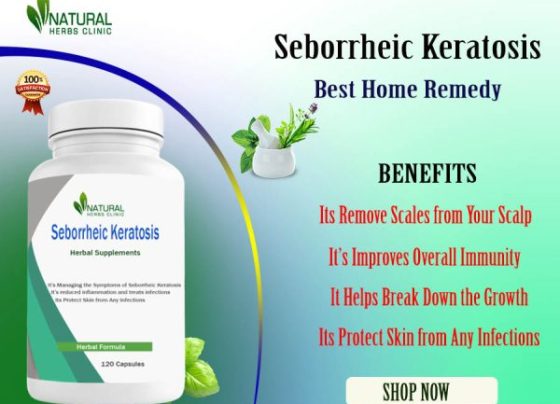 Affected with Seborrheic Keratosis Read about Home Remedies Benefits