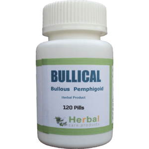 Bullous-Pemphigoid-Herbal-Treatment-500x500-1