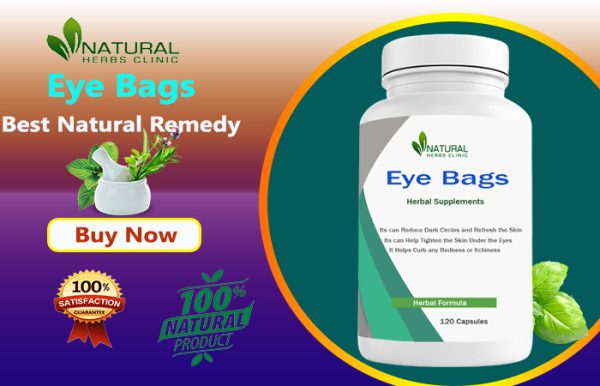 Eye Bags Treatment: Check Out Our Best Natural Remedies to Treat it