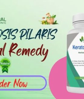 Get Natural Keratosis Pilaris Treatments For Flawless Skin