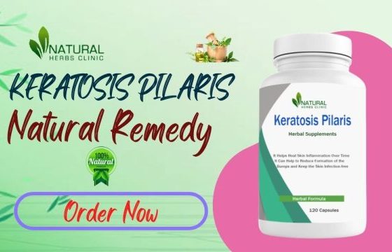 Get Natural Keratosis Pilaris Treatments For Flawless Skin