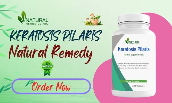 Get Natural Keratosis Pilaris Treatments For Flawless Skin