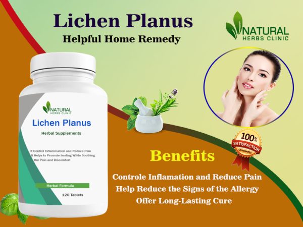 Lichen Planus: Advantages of Natural Treatments and Recovery