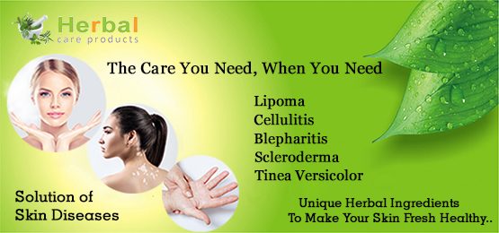 Natural Home Remedies for Health and Skin Diseases