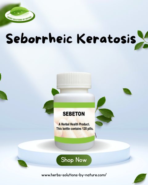 Naturally Treating Seborrheic Keratosis: Tips for At-Home Care