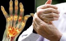 Top 8 Supplements for Arthritis Pain Relief