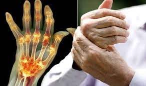 Top 8 Supplements for Arthritis Pain Relief