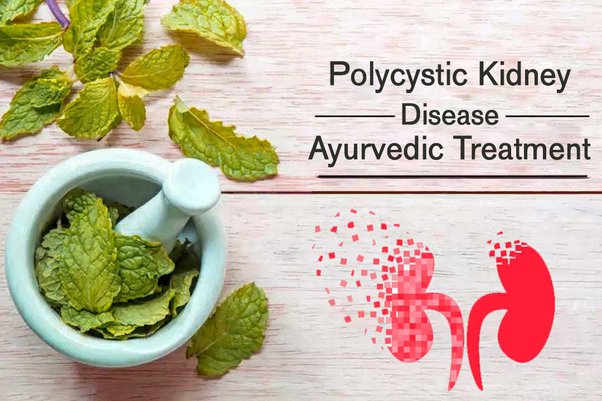 Top 5 Remedies for Managing Adult Polycystic Kidney Disease Naturally