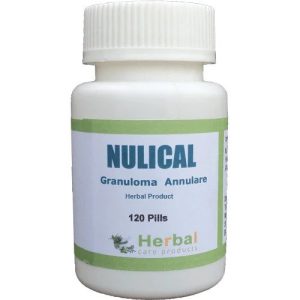 Herbal Supplement for Granuloma Annulare