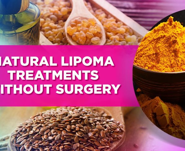 How to Cure Lipoma Proven Methods for Natural Healing