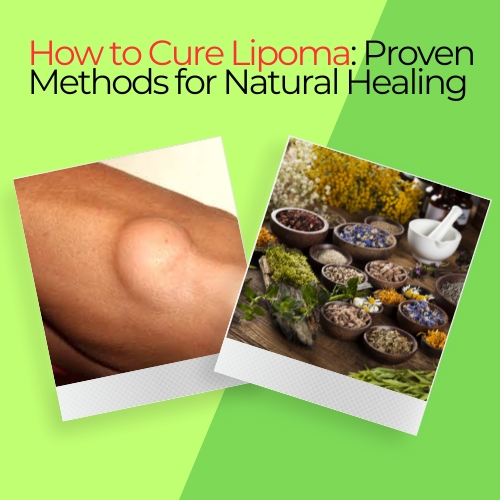 How to Cure Lipoma