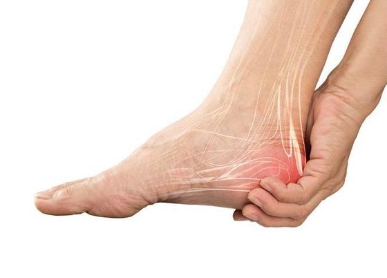 Say Goodbye to Peripheral Neuropathy Pain