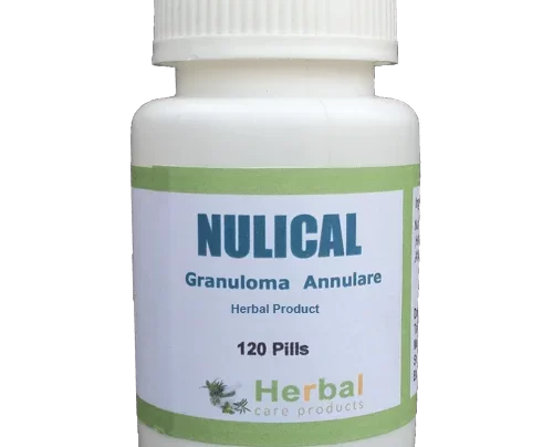 Granuloma-Annulare-Herbal-Treatment-500x500-1-1