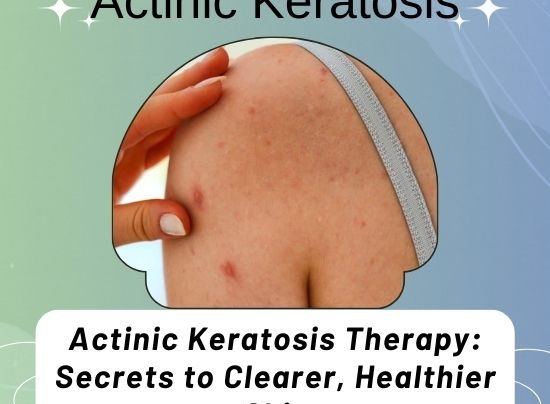 Actinic Keratosis Therapy