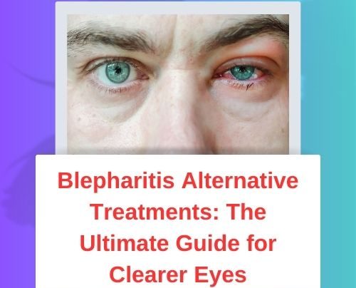 Blepharitis Alternative Treatments The Ultimate Guide for Clearer Eyes