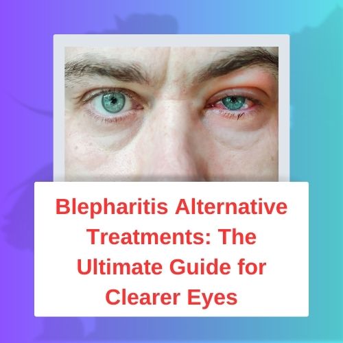 Blepharitis Alternative Treatments: The Ultimate Guide for Clearer Eyes