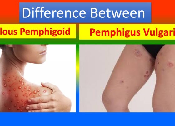 Bullous Pemphigoid and Pemphigus Vulgaris