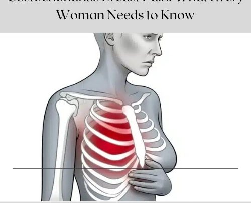 Costochondritis Breast Pain What Every Woman Needs to Know