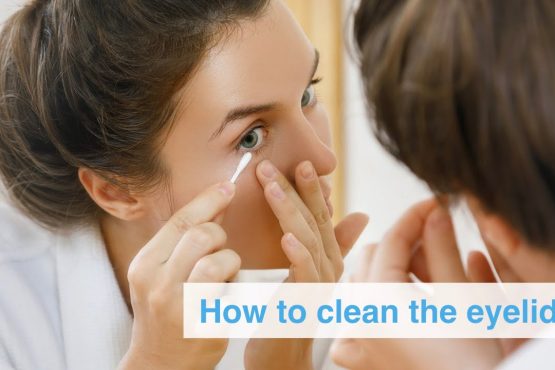 How to Clean Eyelids Blepharitis