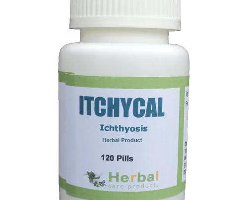 Ichthyosis-Herbal-Treatment-500x500-1-1-1