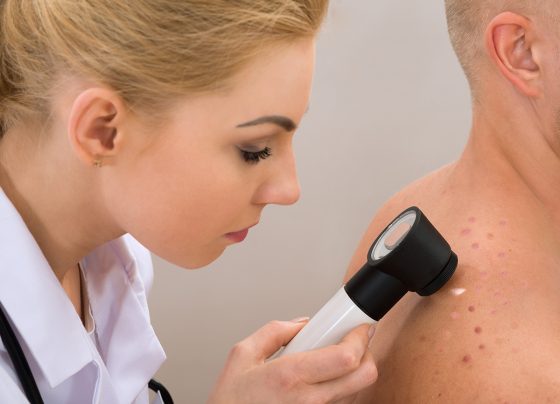 Laser Treatment for Actinic Keratosis