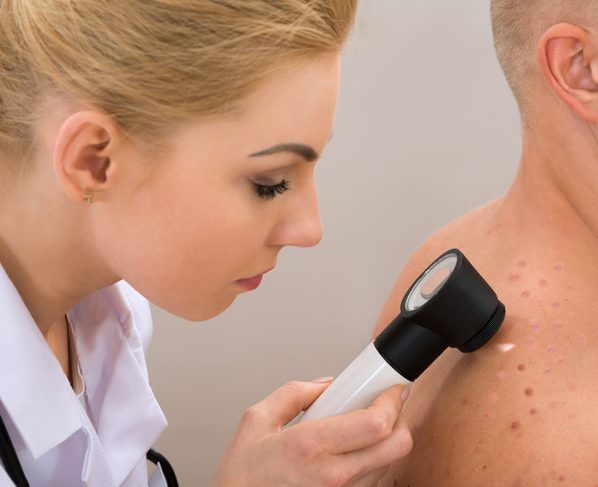 Laser Treatment for Actinic Keratosis