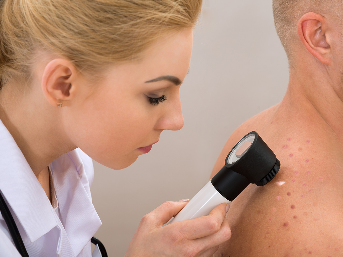 Laser Treatment for Actinic Keratosis: An Effective Solution for Skin Health