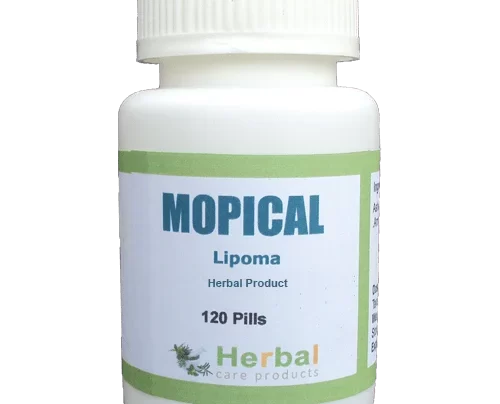 Lipoma-Herbal-Treatment-500x500-1-1