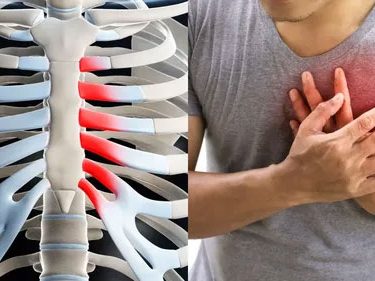 Medications for Costochondritis