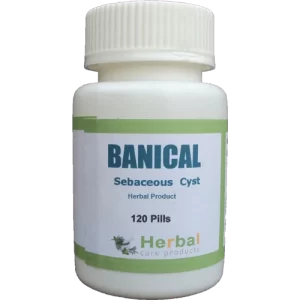 Sebaceous-Cyst-Herbal-Treatment-500x500-1-1 (1)