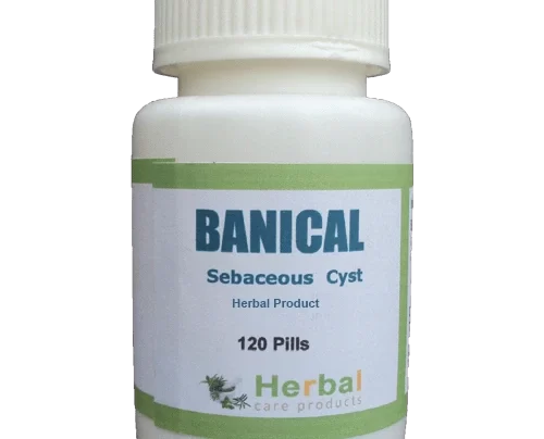 Sebaceous-Cyst-Herbal-Treatment-500x500-1-1