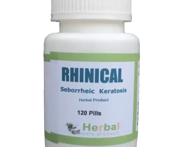 Seborrheic-Keratosis-Herbal-Treatment-500x500-1-1