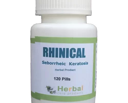 Seborrheic-Keratosis-Herbal-Treatment-500x500-1-1