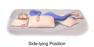 Side-Lying Position with the Affected Lung Up