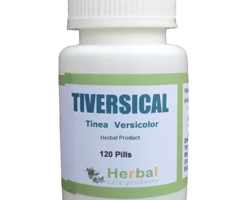 Tinea-Versicolor-Herbal-Treatment-500x500-1-1