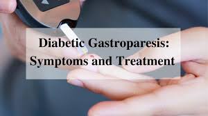 Gastroparesis Diabetes Treatment 1