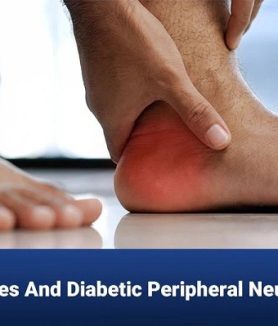 Peripheral Neuropathy and Diabetes